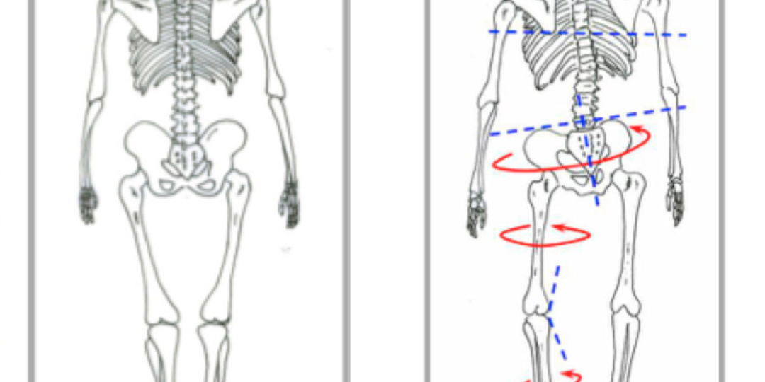 マジックジャンパーは何に効果があるの