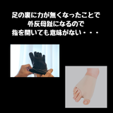 リハビリインソール
