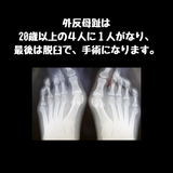 リハビリインソール